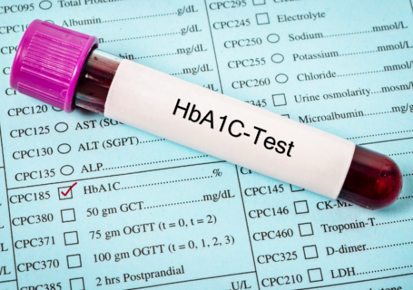 Hemoglobin A1C - $29