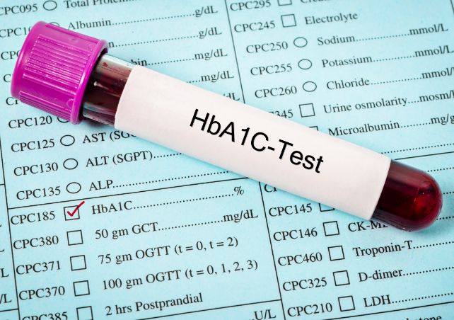 Hemoglobin A1C - $29
